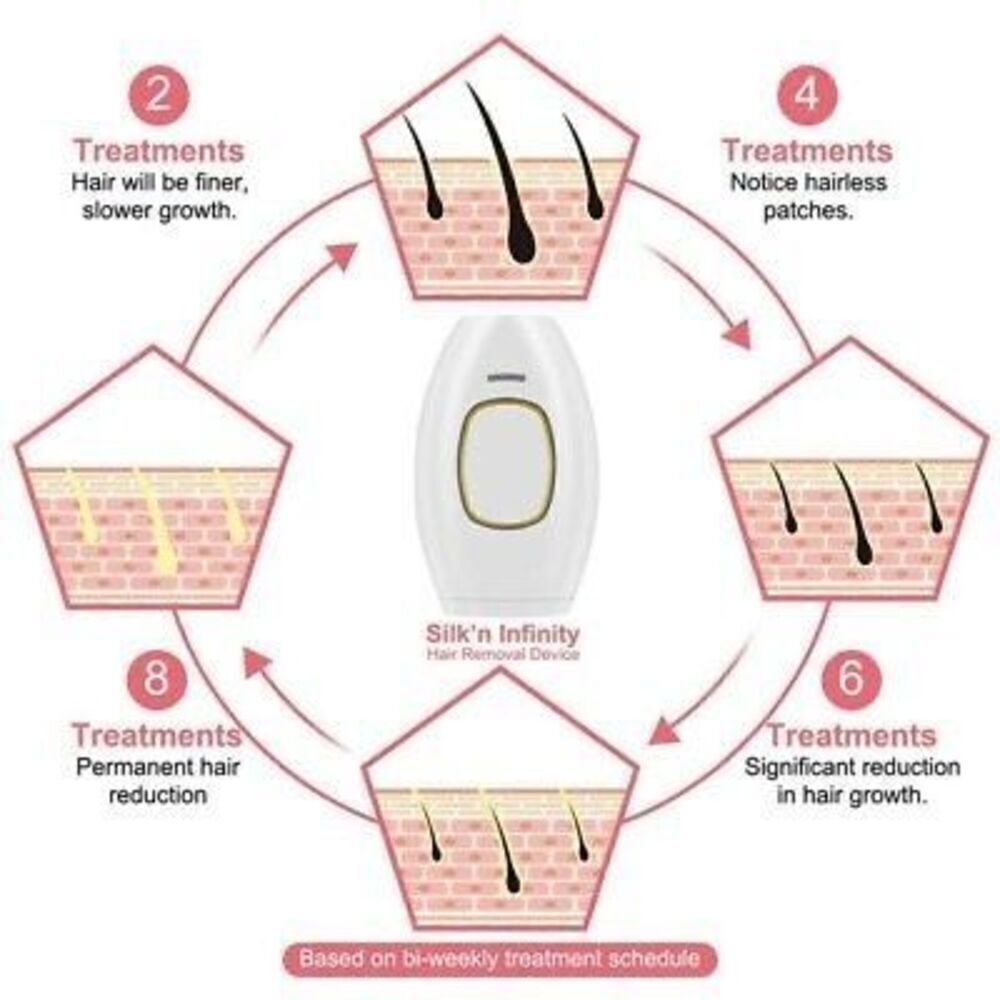 Hey Silky Skin Women's Advanced IPL Hair Removal Handset Rose Gold Pink New - Picture 11 of 15